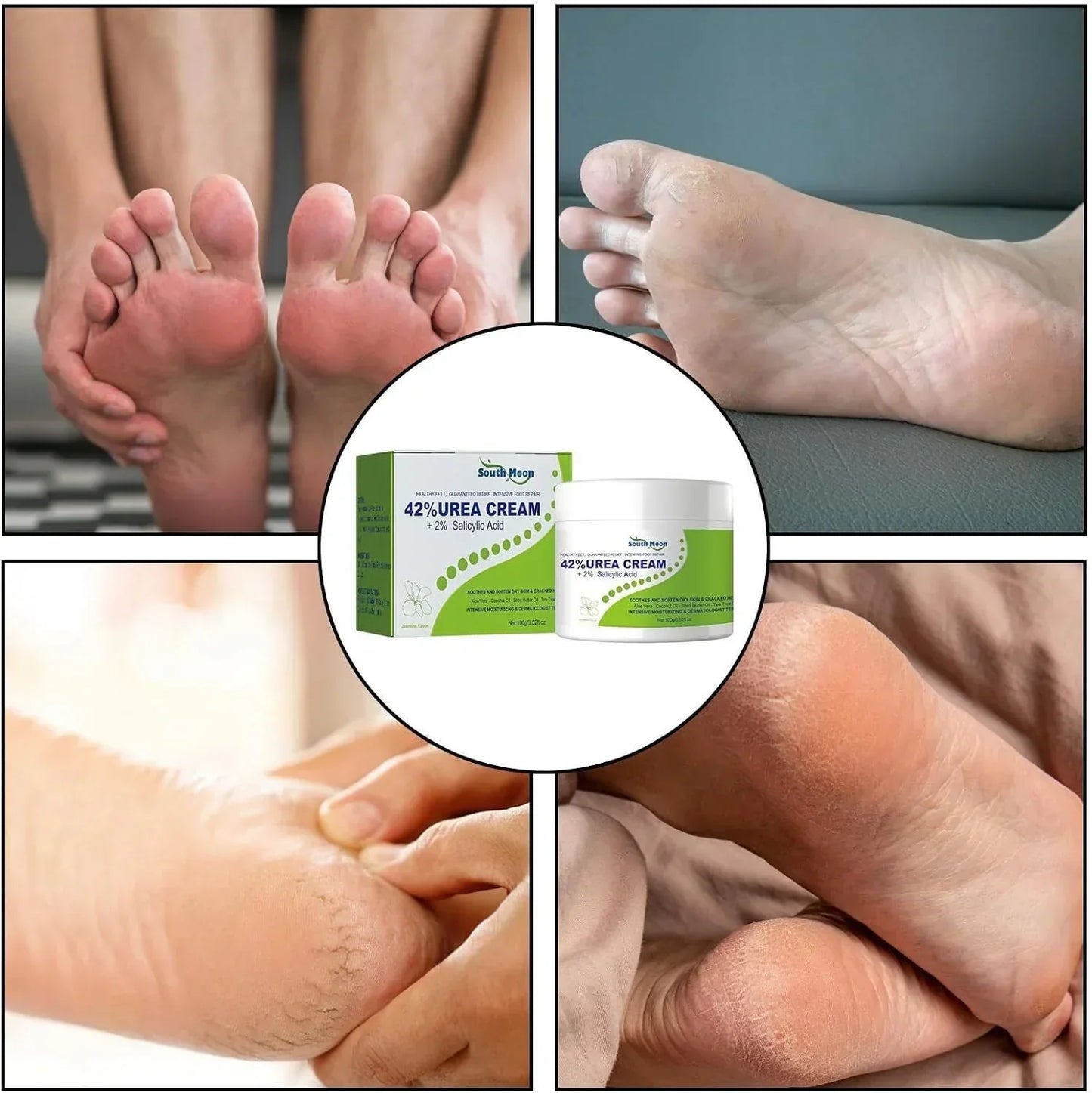 South Moon - 42% Urea Cream + 2% Salicylic Acid (Original) - Falcon Mall