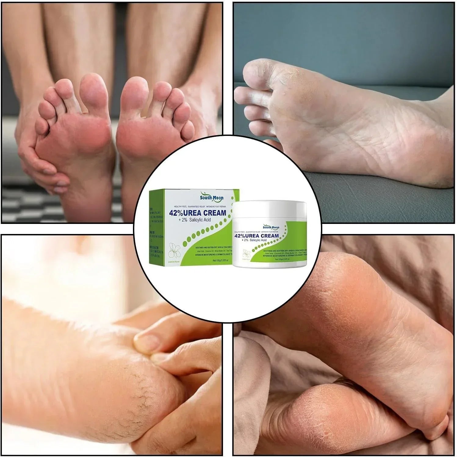 South Moon - 42% Urea Cream + 2% Salicylic Acid (Original) - Falcon Mall