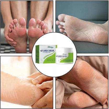 South Moon - 42% Urea Cream + 2% Salicylic Acid (Original) - Falcon Mall